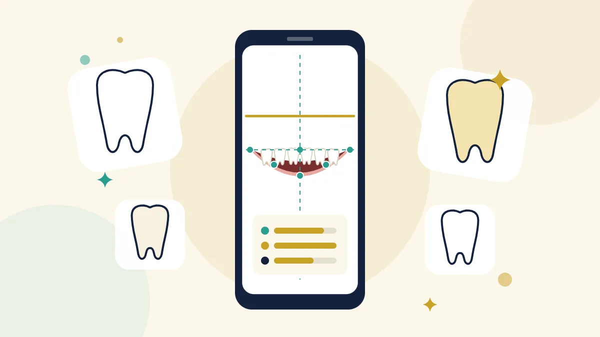 BrassSmile AI smile analysis illustration showing a smartphone scanning a smile with facial landmark points