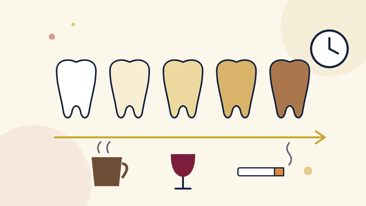 Why teeth lose their brightness: teeth shading from white to yellow and brown beside coffee, wine and tobacco stain causes